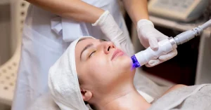 Apa Efek Laser Penghilang Jerawat