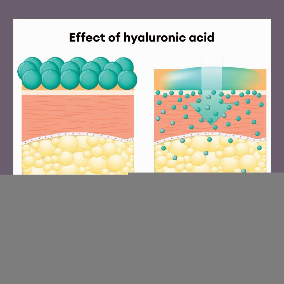 Apa Manfaat Hyaluronic Acid Untuk Dehydrated Skin