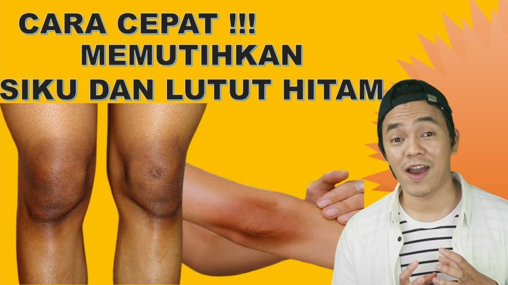 Bagaimana Cara Memutihkan Siku Yang Hitam