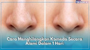 Bagaimana Cara Mengangkat Komedo Secara Alami