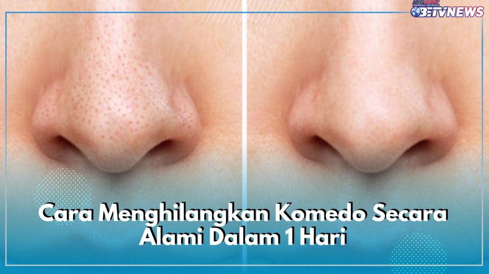 Bagaimana Cara Mengangkat Komedo Secara Alami
