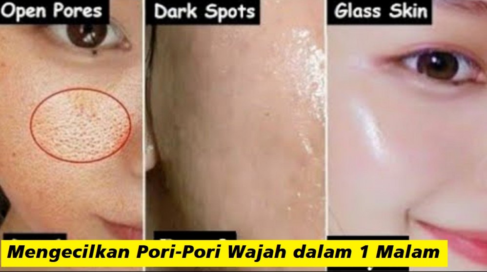 Bagaimana Cara Mengecilkan Pori Pori Secara Permanen