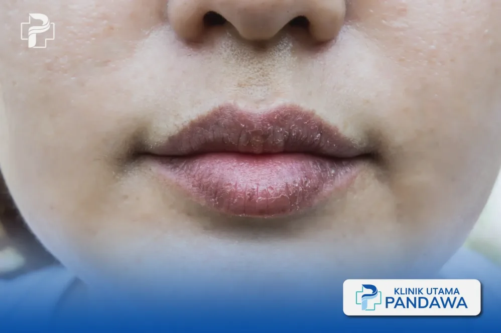 Kenapa Area Bibir Hitam