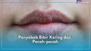 Kenapa Bibir Cepat Kering Meski Sering Minum