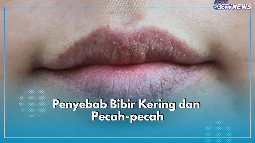 Kenapa Bibir Cepat Kering Meski Sering Minum