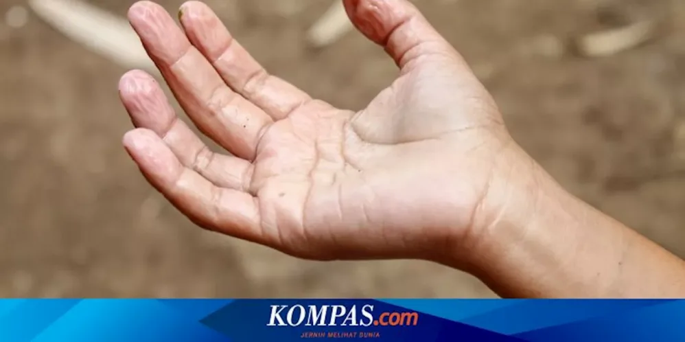 Kenapa Kulit Tangan Tipis Dan Berkerut