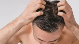 Kenapa Rambut Bercabang Meski Sudah Dirawat