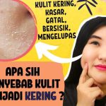 Kenapa Wajah Berminyak Tapi Terkelupas