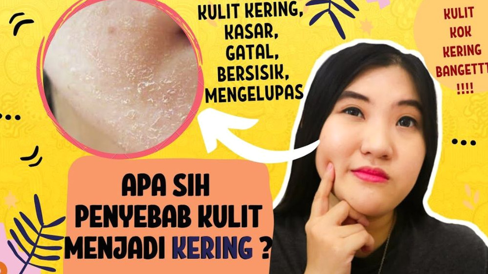 Kenapa Wajah Berminyak Tapi Terkelupas